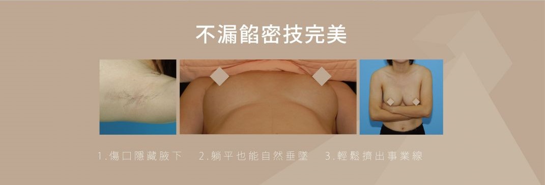隆乳手術不露餡密技：傷口隱藏腋下、躺平也能自然垂墜、輕鬆擠出事業線