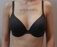 隆乳術後內衣選購 隆乳術後內衣選購