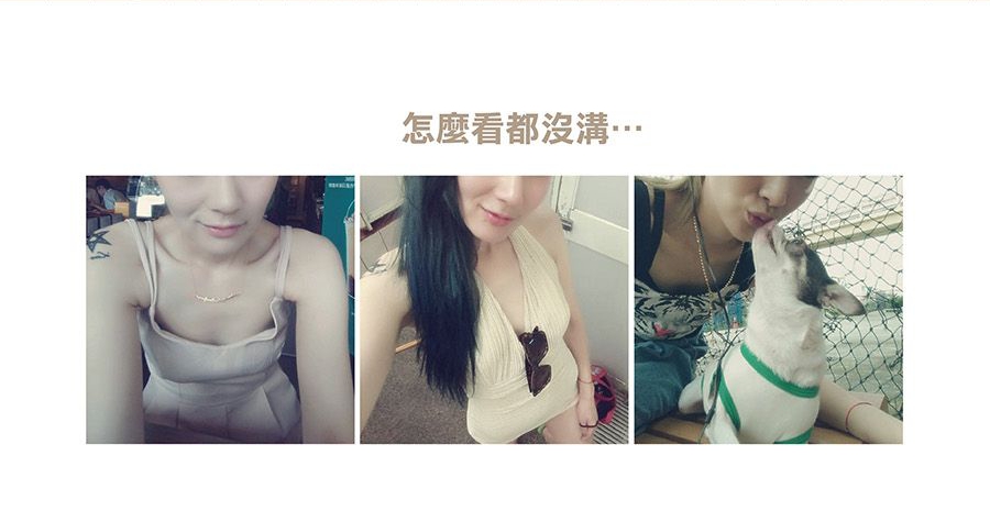 水滴形內視鏡隆乳手術前 水滴形內視鏡隆乳手術前